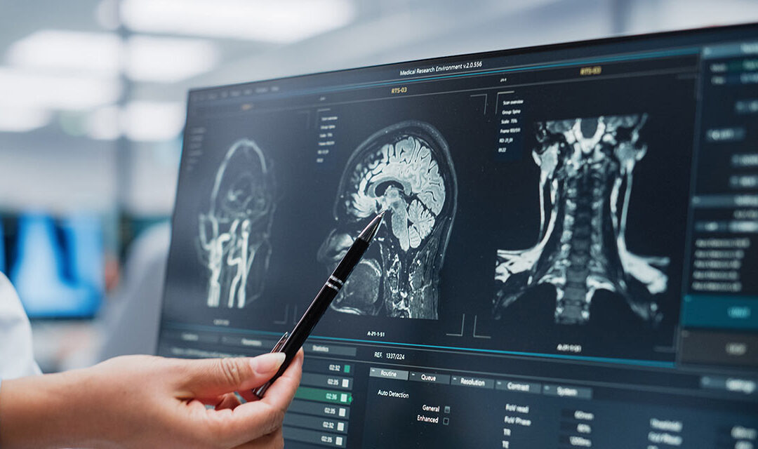 Objective Evidence On Image Quality Points To a Clear Choice For CT